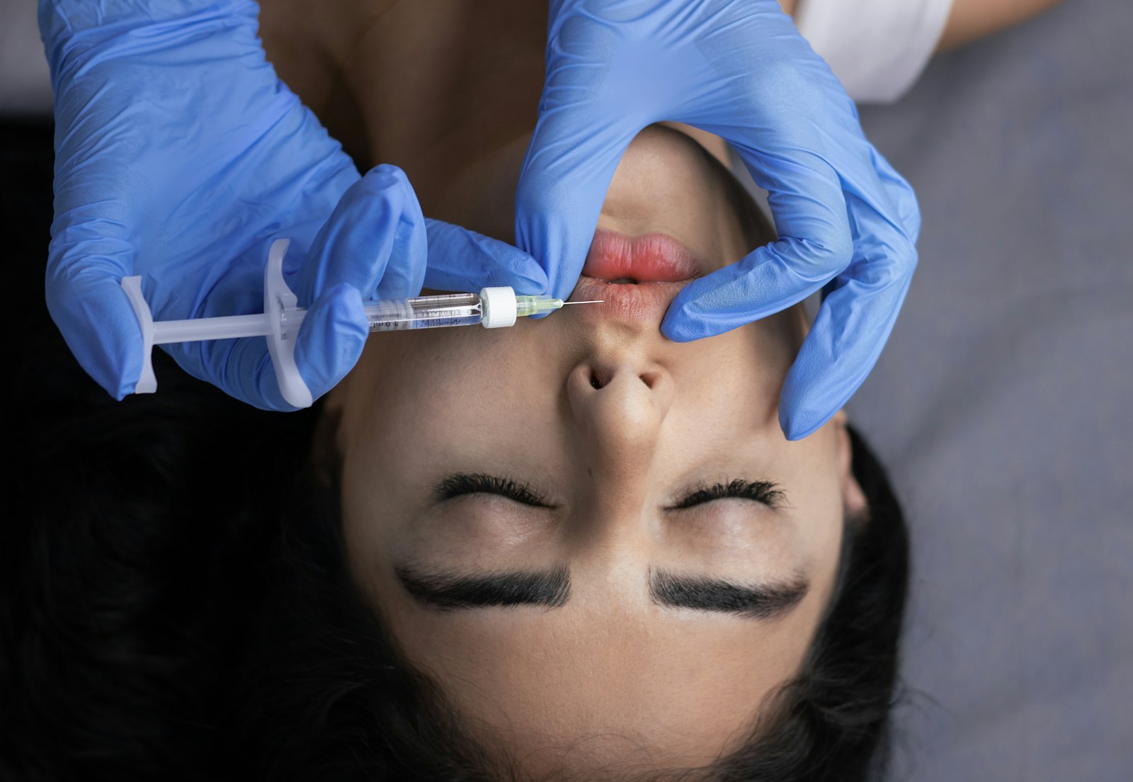 Dermal Fillers in Manchester