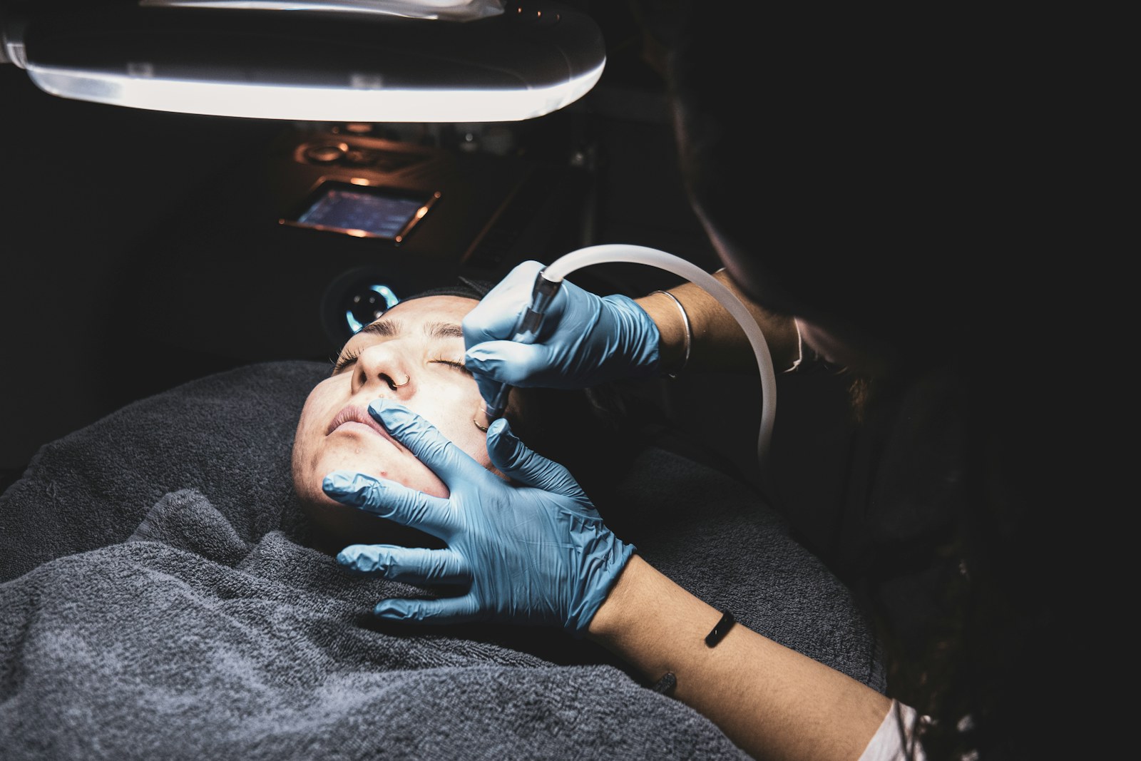 Microneedling in Manchester